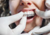 Sådan får du bedst rettet dine tænder Invisalign